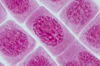 Mitose racine d'Ail PROPHASE x640